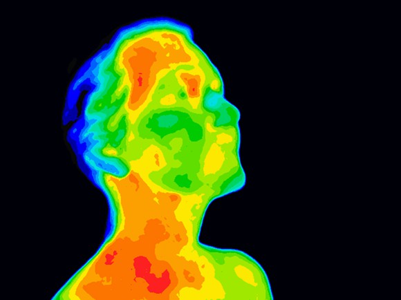 A thermographic image of a man's head and shoulders.