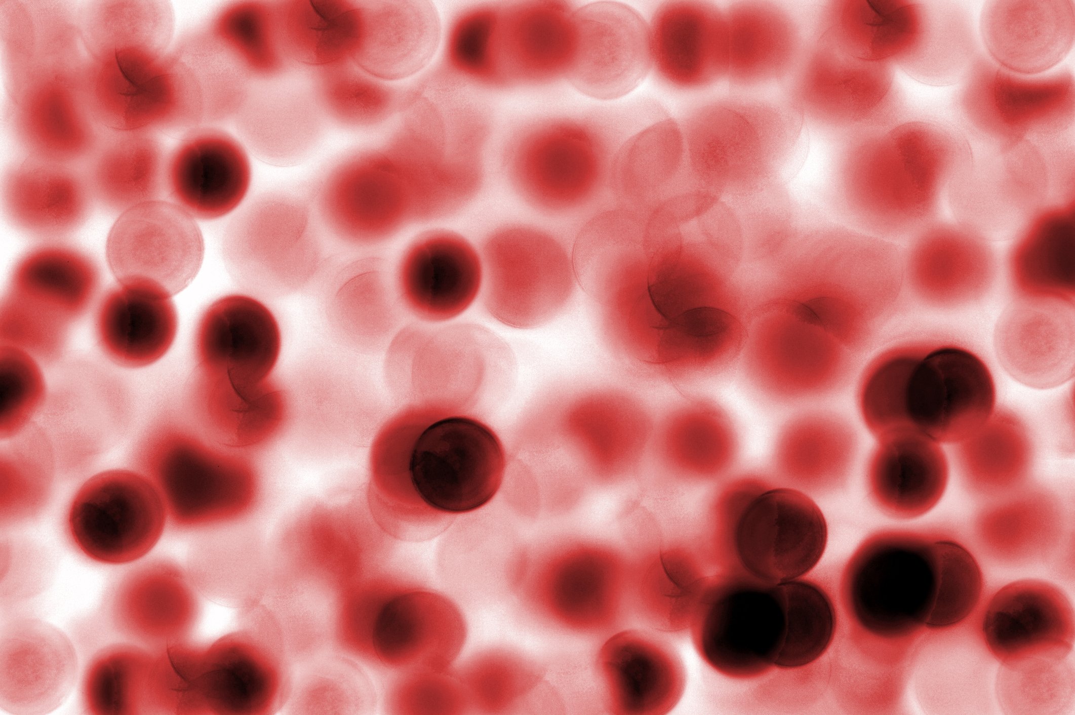 A closeup of blood cells.