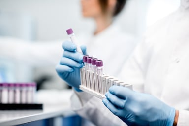 sample-tubes-olympus-rack-getty