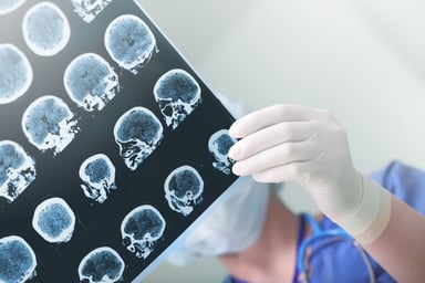 Physician-examining-brain-scans-getty