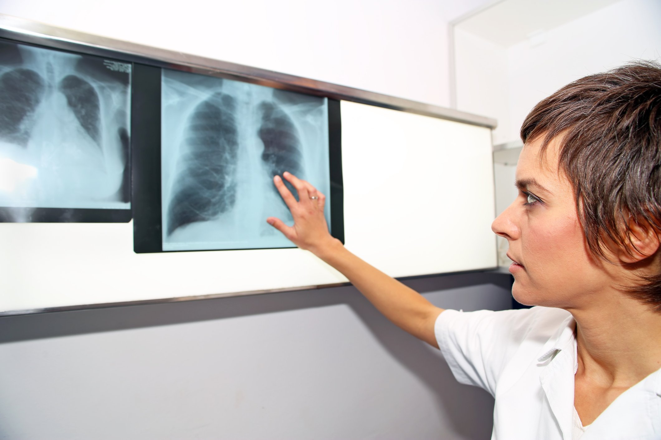 A doctor inspecting a lung X-ray