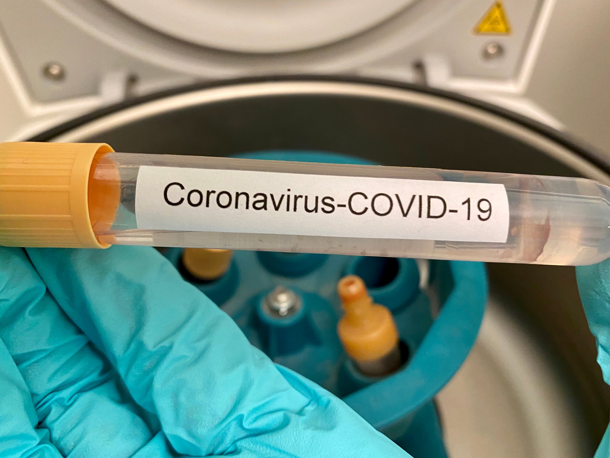Gloved hand holding test tube with "Coronavirus-COVID-19" printed on label and a centrifuge in the background
