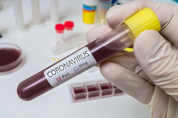 Gloved hand holding vial with label indicating a positive coronavirus result