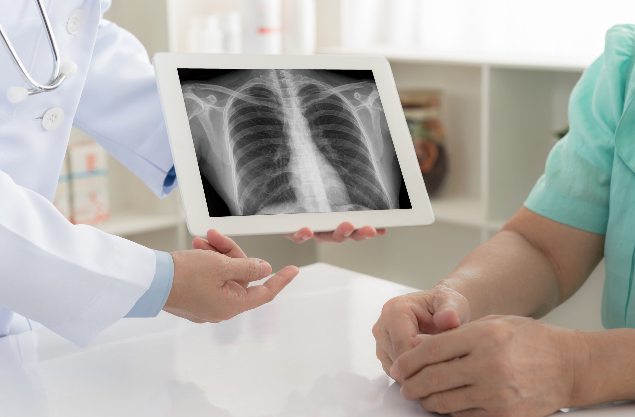 Doctor shows patient a chest x-ray
