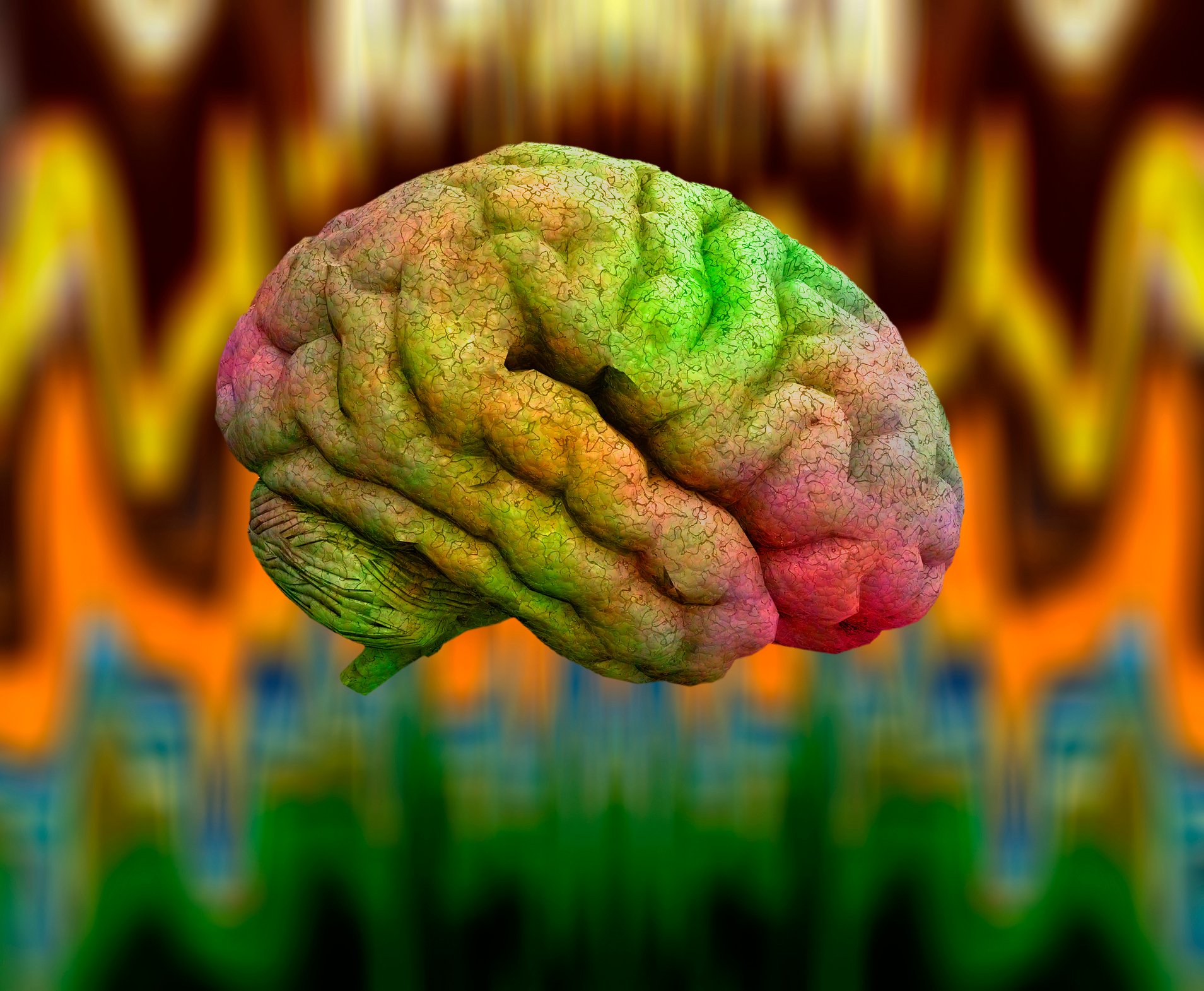 A multi-colored human brain.