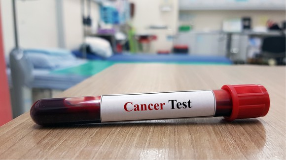 Vial of blood with label reading "Cancer Test"