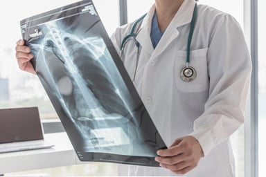 Physician looking at scan of lungs