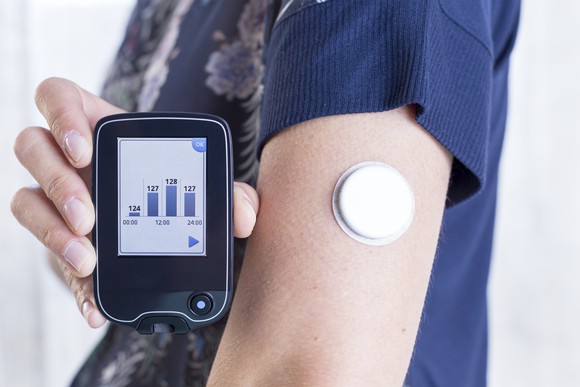 Diabetes patient with continuous glucose monitor on their arm and a handheld reader.