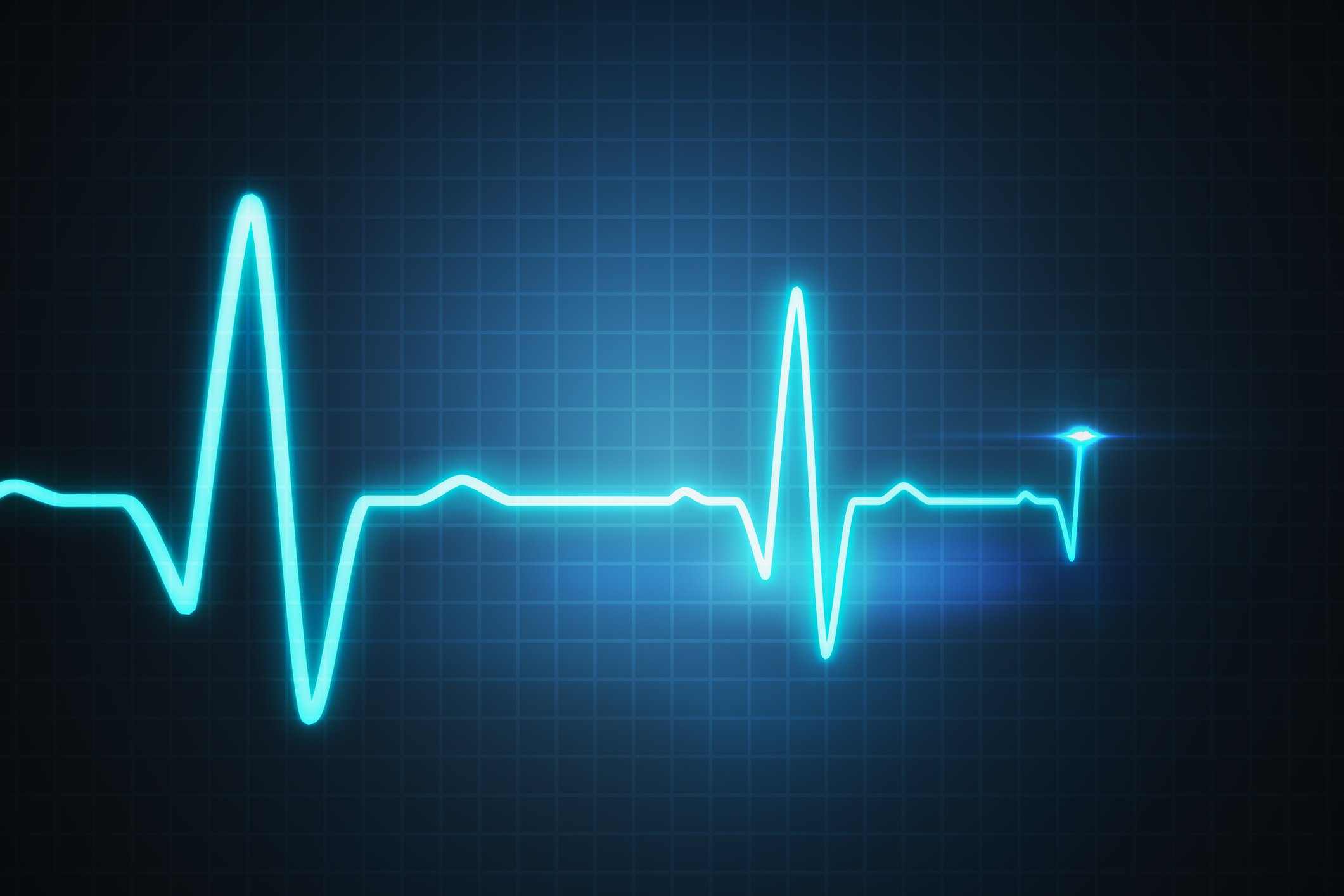 Electrocardiogram display