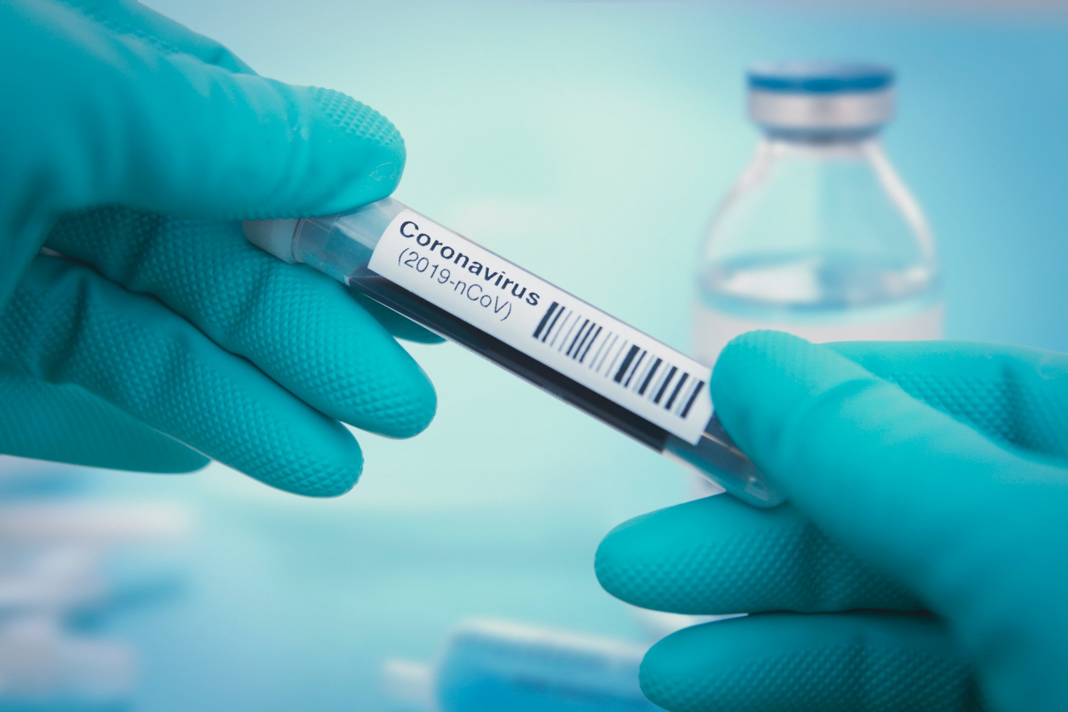 A person wearing gloves and holding a test tube labeled "Coronavirus 2019-nCoV).