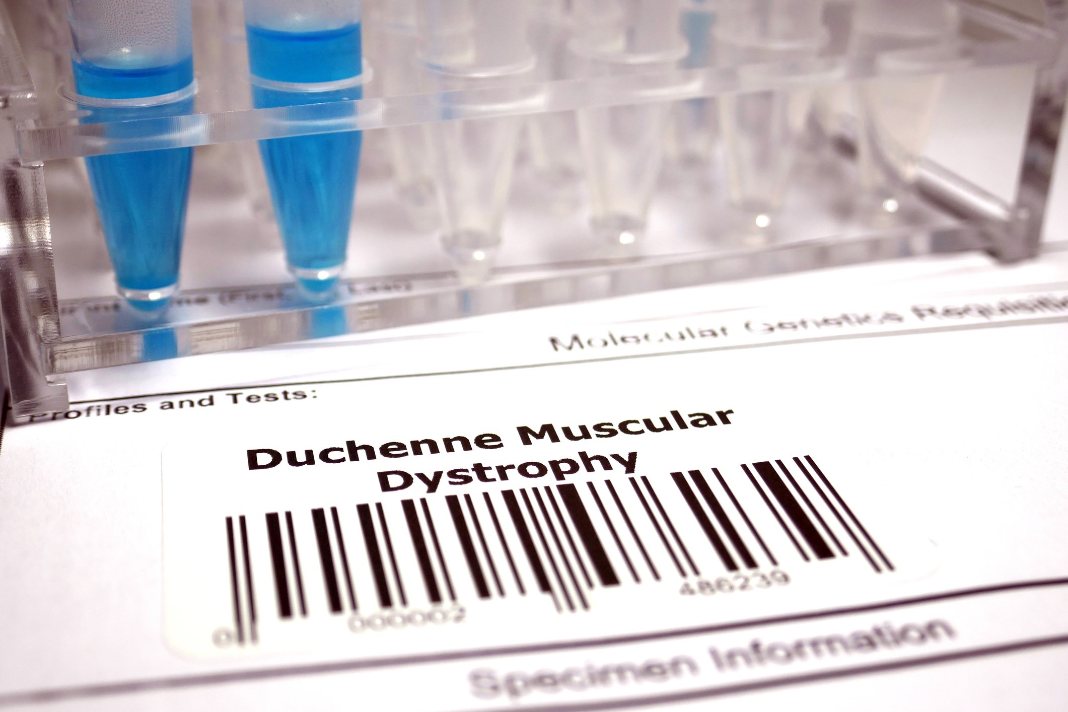 Duchenne muscular dystrophy