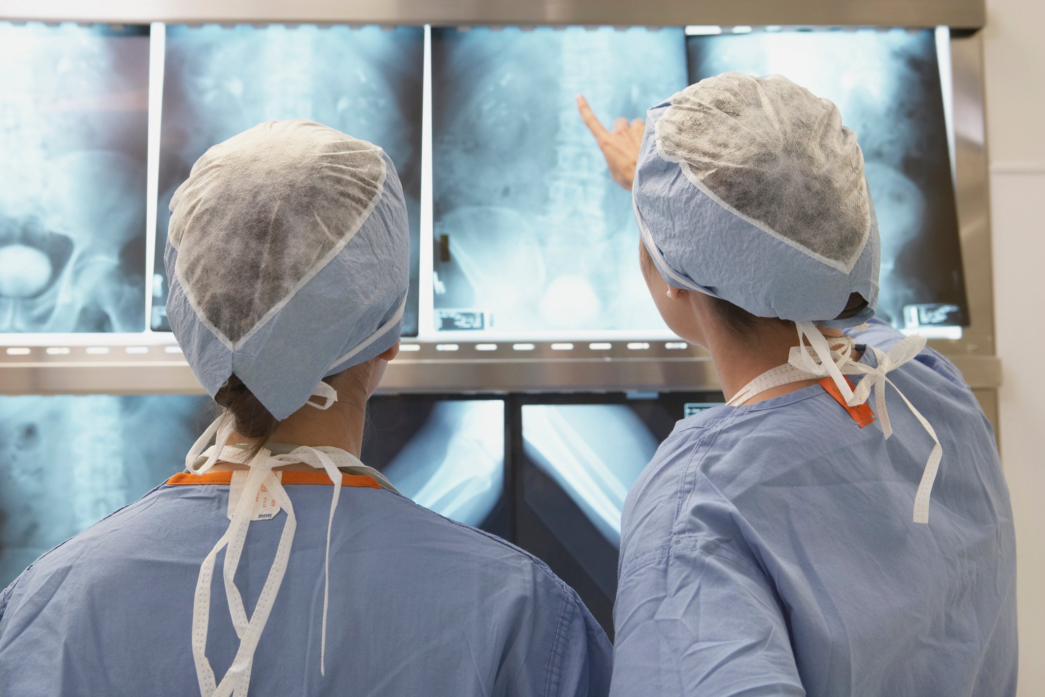 Two doctors consult several X-ray scans of the lumbar region.