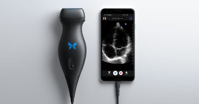 Butterfly Networks mobile device, hooked up to a smart phone, showing an ultrasound of an unborn baby