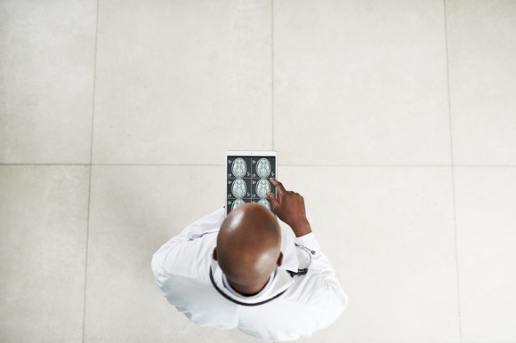 person pointing at brain images