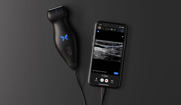 Butterfly iQ+ next to a smartphone with an app showing an ultrasound