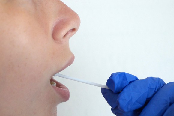 Gloved hand holding a cotton swab in a person's mouth.