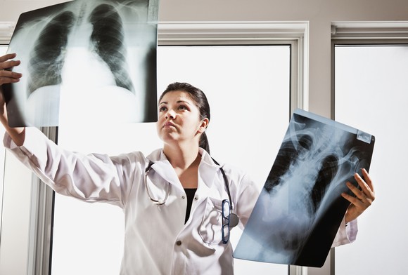 Doctor examining chest x-rays.