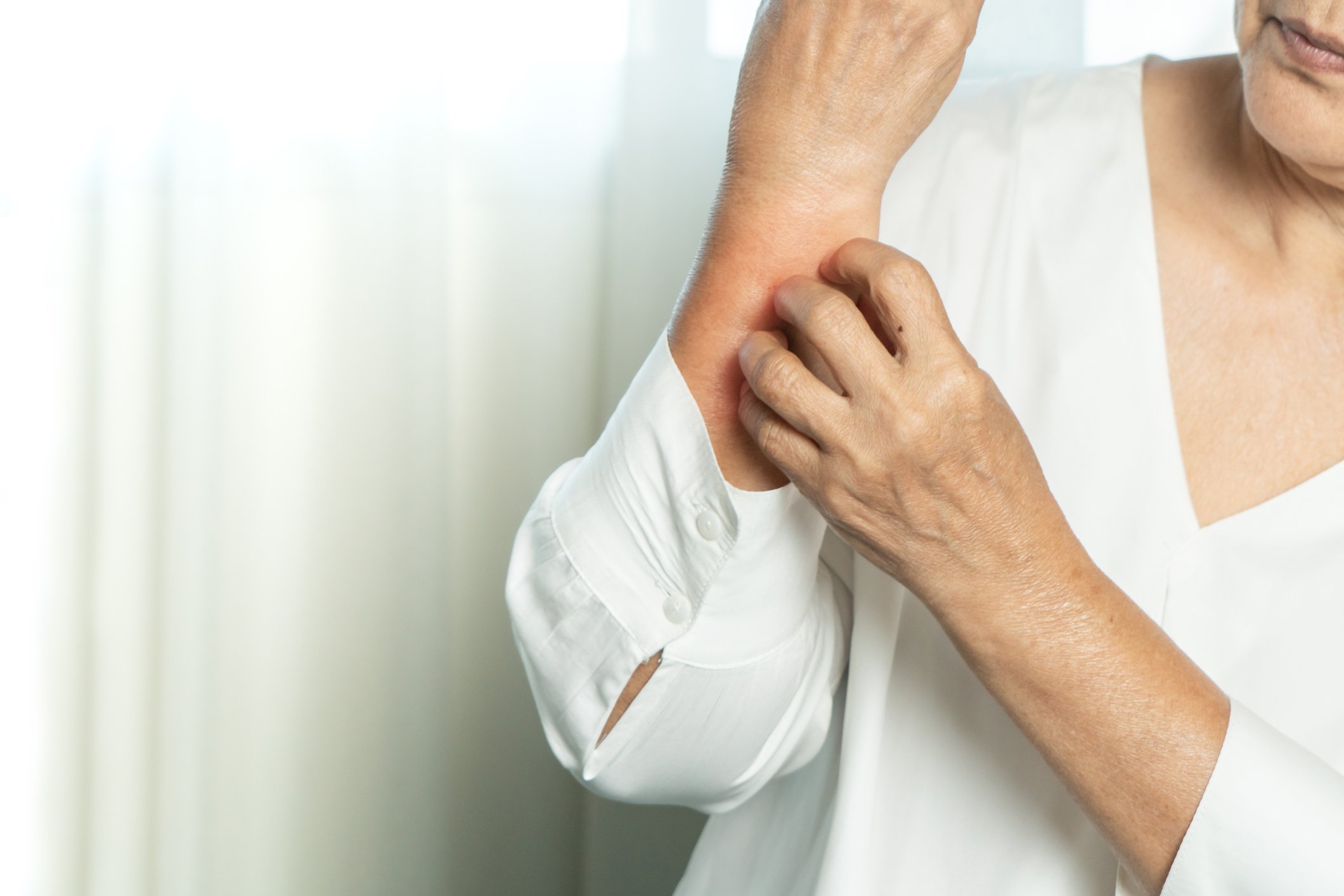 Older person scratching arm