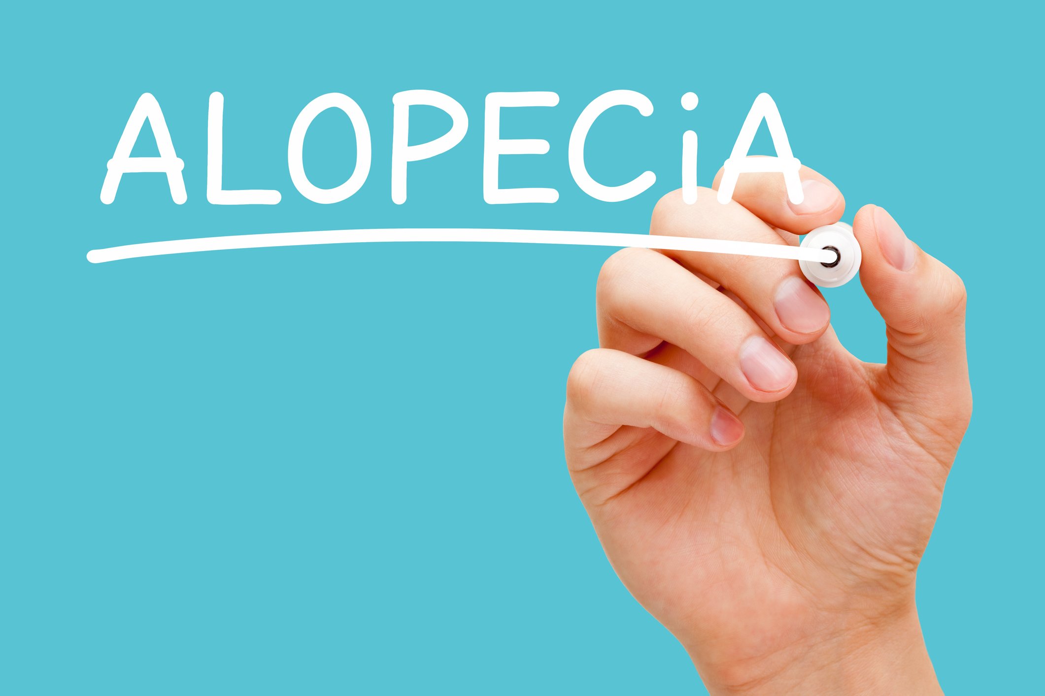 A hand writes the word "Alopecia" in white on a blue background.