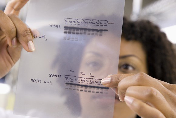 A researcher examines a genetic sequence on transparent slide.