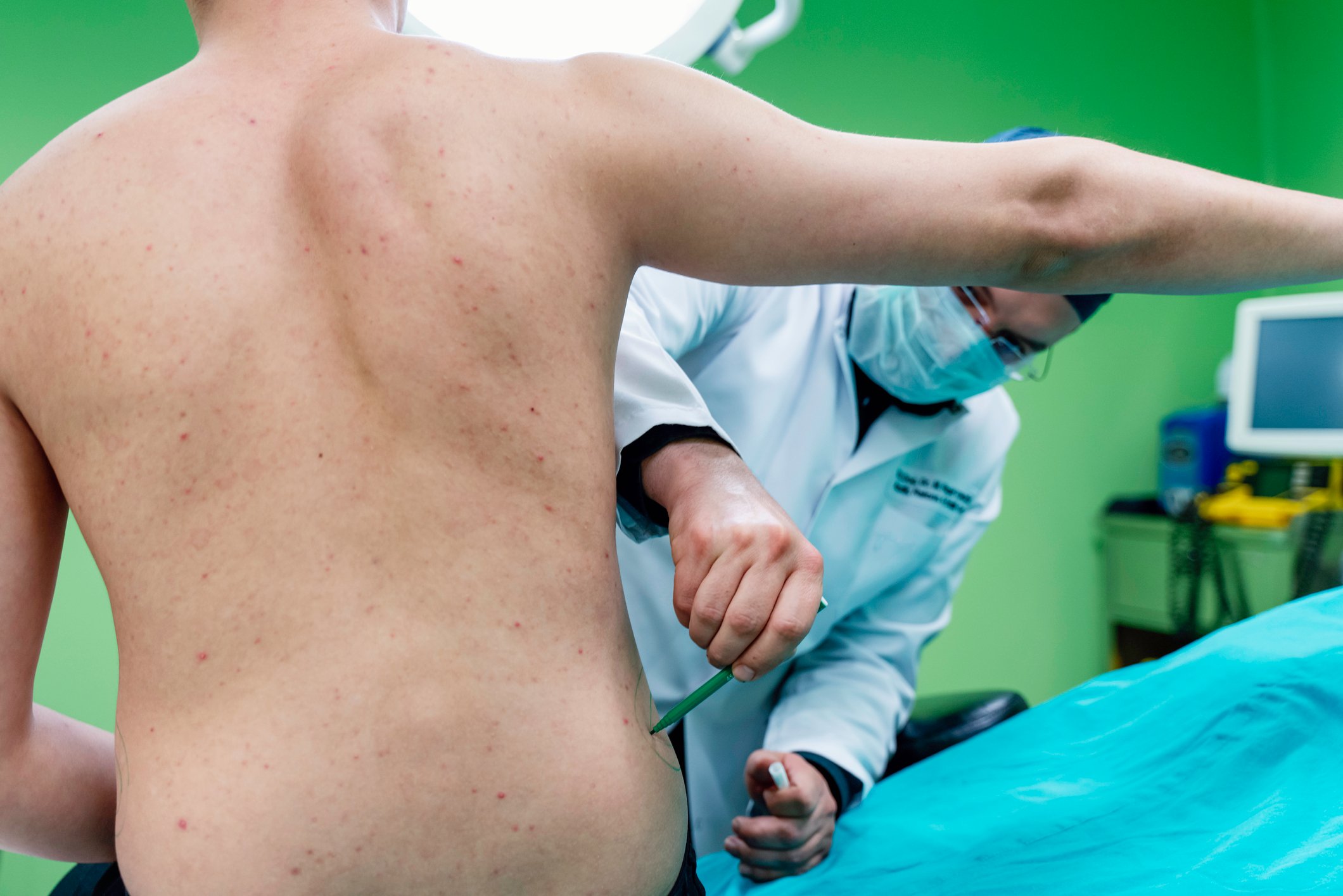 A plastic surgeon marks a person's body prior to a procedure.