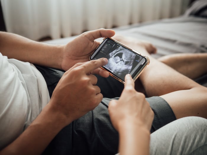 Young pregnant couple lying down on bed while watching 3D ultrasound video of a baby on a smart phone.