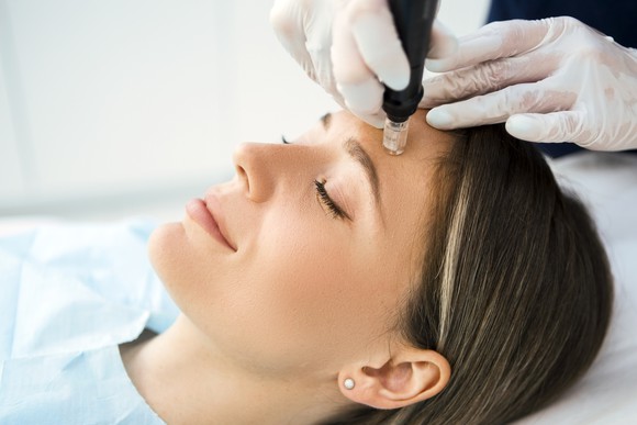 Person receiving cosmetic treatment on their face while laying down with their eyes closed.