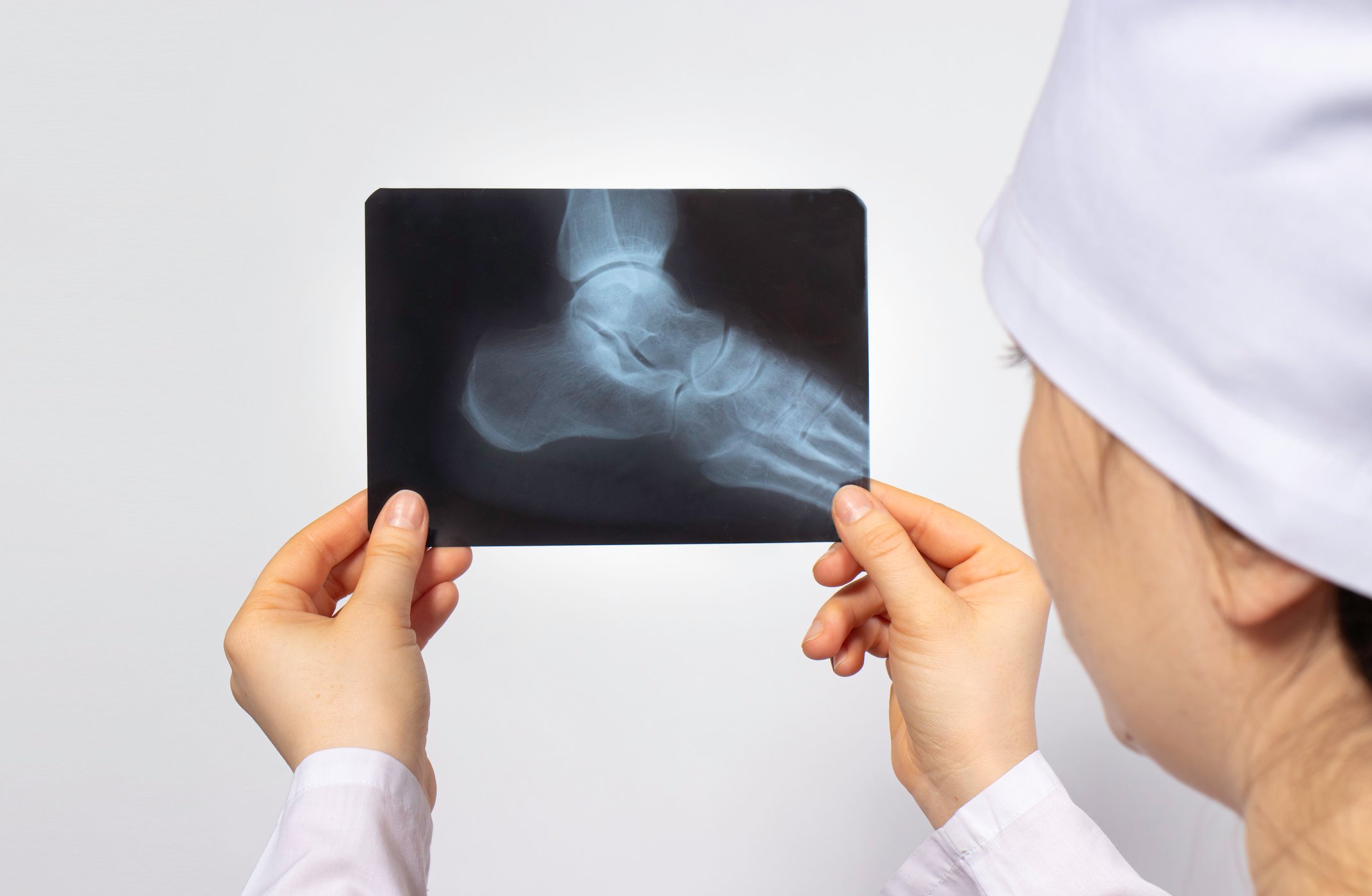 A healthcare professional holding an X-ray of a person's foot.