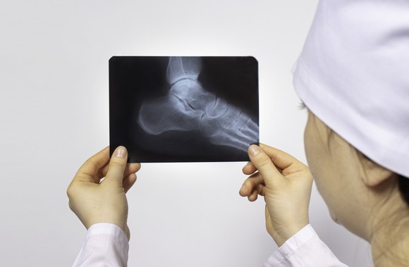 A healthcare professional holding an X-ray of a person's foot.