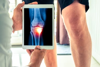 Knee x-ray