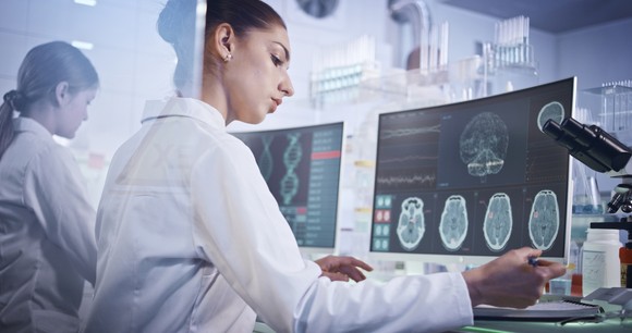 Doctors are reviewing brain scans on computers.