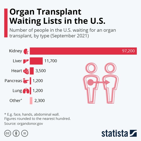 Organ transplant waiting list in the U.S.