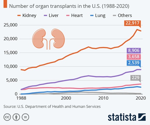 A chart depicting the number of organ transplants in the U.S. Kidney transplants are on the rise. 