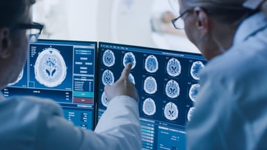 Scientists looking at brain scans