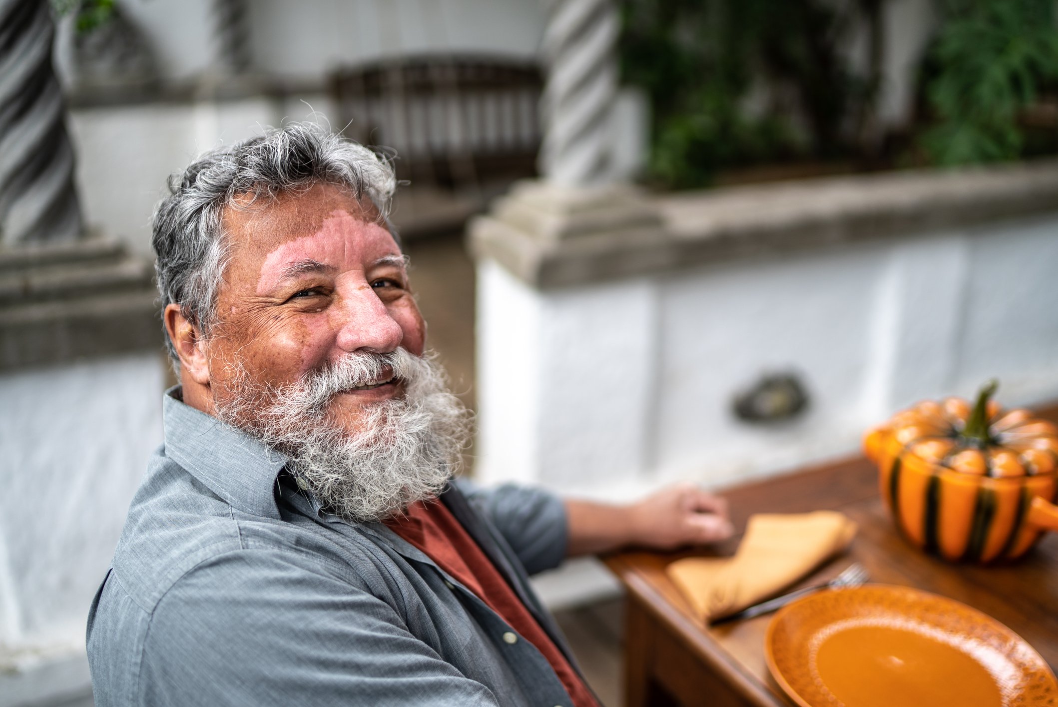 Confident experienced vitiligo