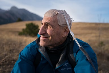 Novocure person with TTFields on head