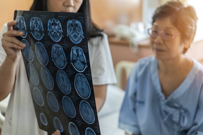 A medical professional discusses the results of a brain scan with an older person.