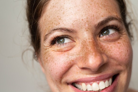 Someone with freckles is smiling broadly.