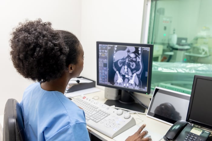 A person looks at a medical scan on a computer monitor.
