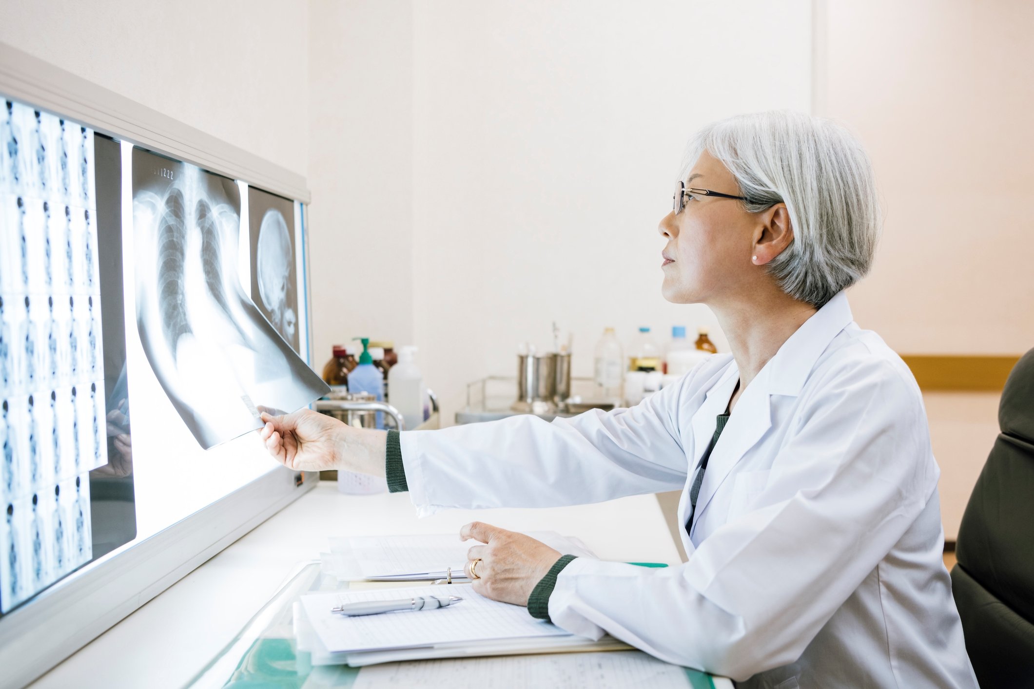 Doctor looking at a chest x-ray.