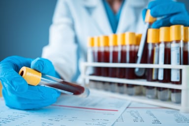 Vials of blood