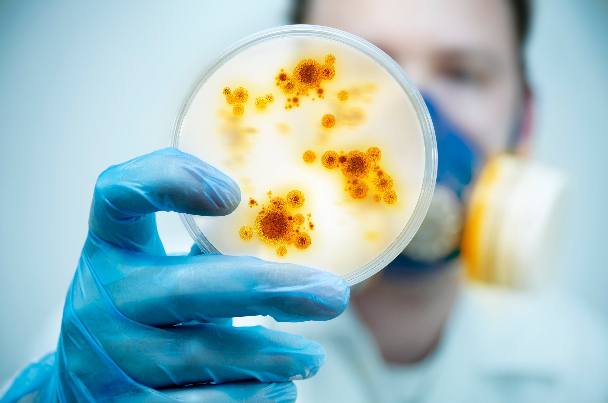 Lab worker with safety mask holding a petri dish with yellowish cells.