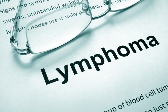 Paper with word "lymphoma" and glasses