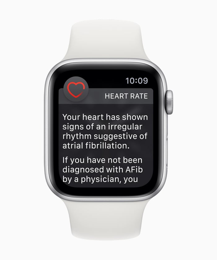 An Apple Watch with a notification of an irregular heart rhythm. 