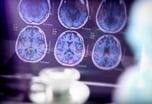 Brain scans