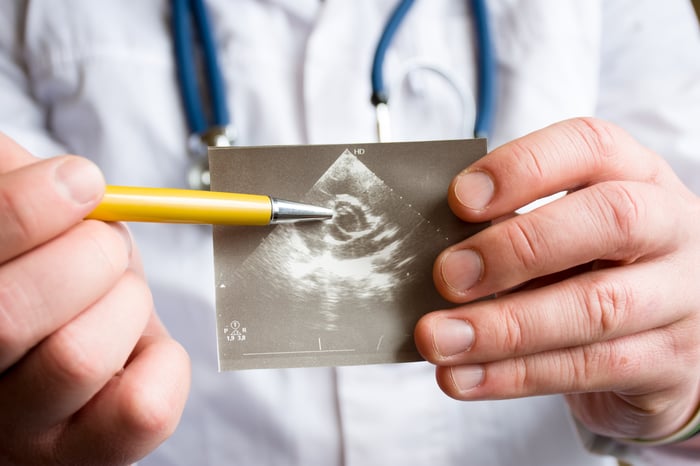 A doctor points to the aorta with his pen in an ultrasound image of the heart.