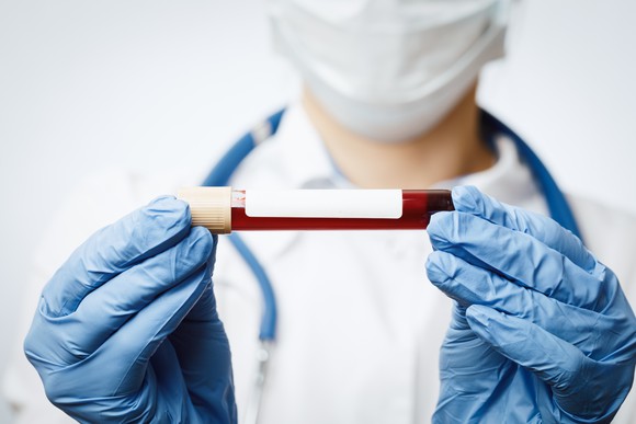A medical profession wearing a mask and gloves holding a vial of blood.