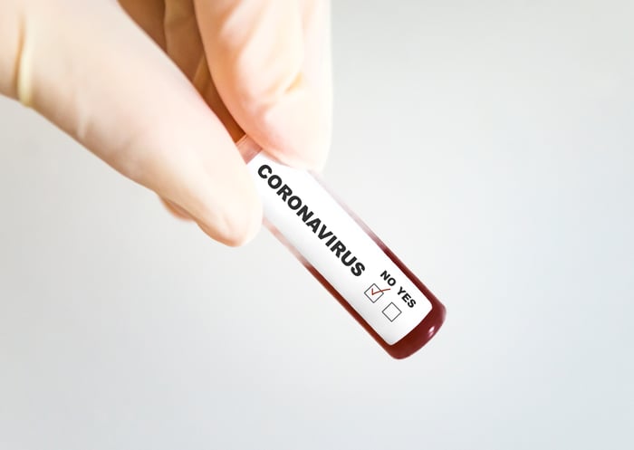 A gloved hand holding a vial of blood with a label that reads "Coronavirus: No." 