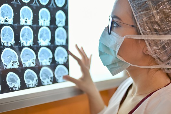 Doctor reviewing brain MRI scans