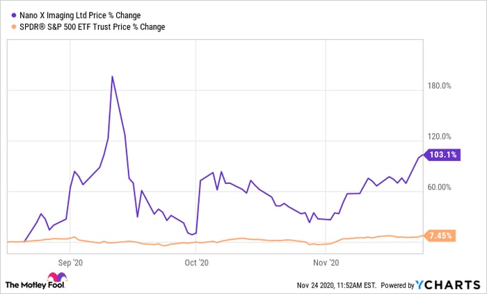 stock chart Nano-X